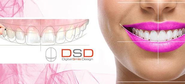 لمینت دندان چیست و لمینت برای چه دندان هایی مناسب است؟