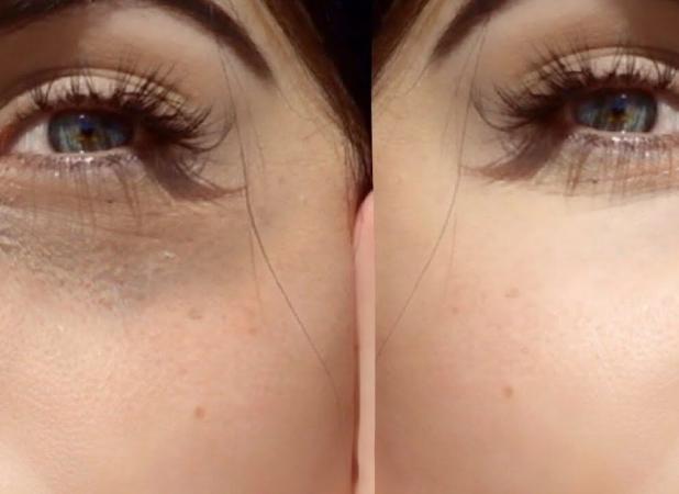 راهکار های کاهش تیرگی و پف دور چشم در خانه