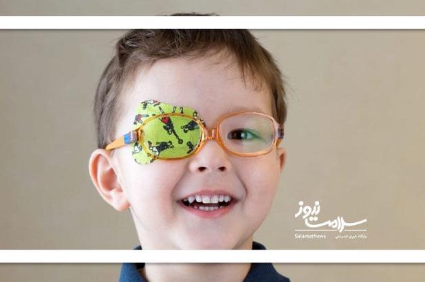 درمانی نوین برای تنبلی چشم: قطع ورودی بینایی برای بازیابی بینایی!