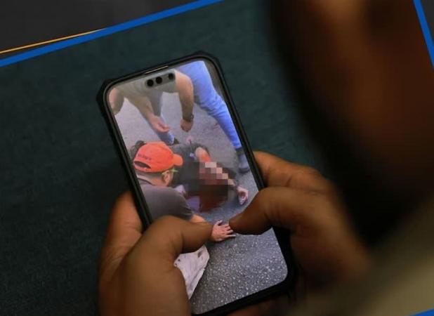 انجام ۱۵۰۰ عمل جراحی برای مجروحان حادثه لبنان در ایران