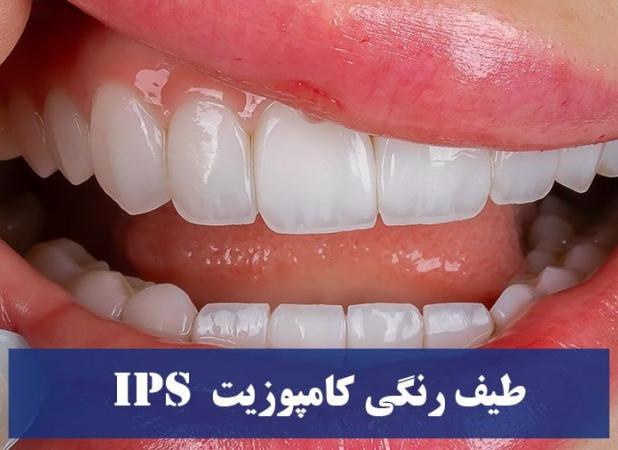 طیف رنگی کامپوزیت IPS : رنگ BLXL و رنگ bll