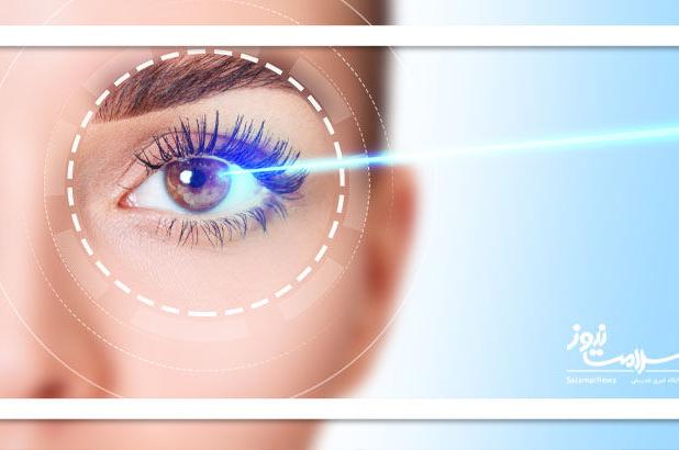 لیزیک را فراموش کنید: روش اصلاح بینایی ایمن‌تر و ارزان‌تر به زودی عرضه می‌شود