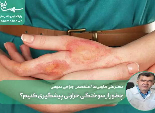 چطور از سوختگی حرارتی پیشگیری کنیم؟