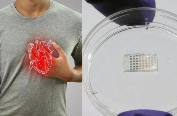 هیدروژلی که قلب را پس از سکته درمان می کند