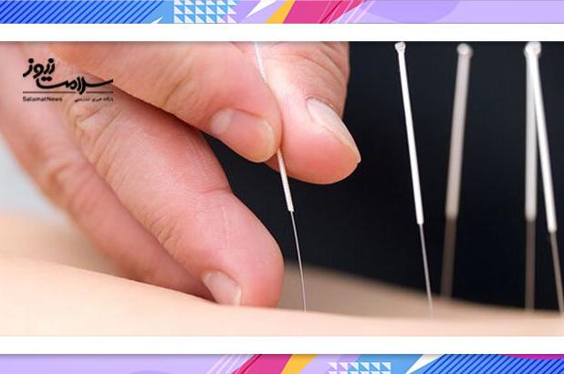 طب سوزنی؛ راهی نو برای تسکین کمردرد مزمن سالمندان
