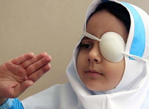 ۲۹ درصد از کودکان در دشتستان تحت پوشش غربالگری چشم قرار گرفتند