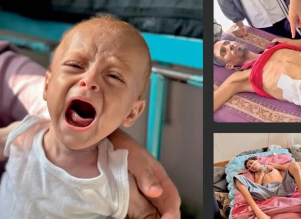 اذعان «هاآرتص» به فجایع غزه؛ همه جا را گرسنگی فراگرفته است+ تصاویر
