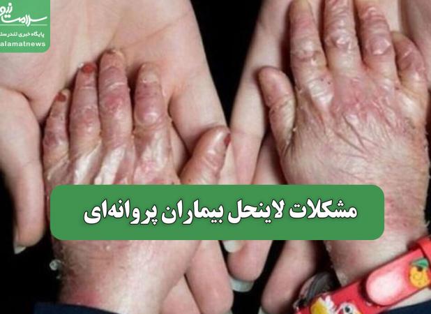 مشکلات لاینحل بیماران پروانه‌ای