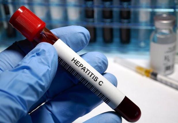 اجرای موفق برنامه کشوری حذف هپاتیت C در یزد