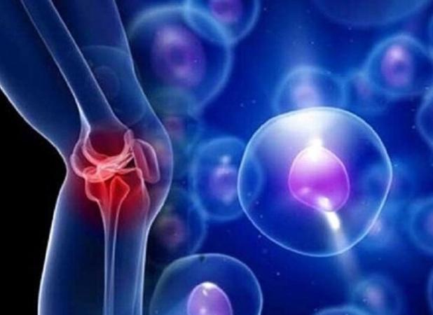 موفقیت دانشمندان ایرانی در ترمیم استخوان با فناوری نانو