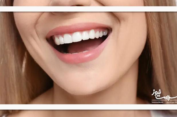 ژل نوآورانه‌ای که مینای دندان را ظرف چند هفته بازسازی می‌کند
