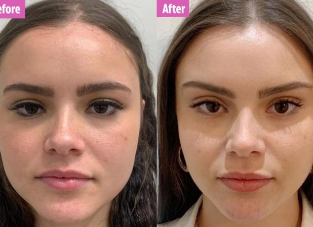 بهترین پزشک برای لیفت صورت با نخ + معرفی ۱۰ پزشک برتر