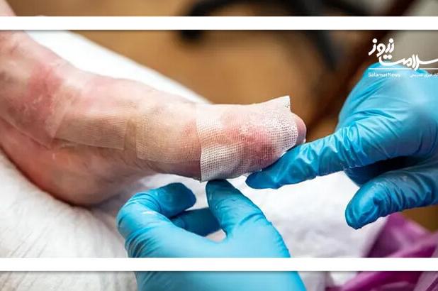 درخواست خانواده‌های بیماران ای‌بی از دولت: گام‌های مؤثر برای رفع دغدغه‌های درمانی و دارویی بیماران پروانه‌ای