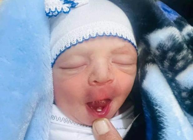 این نوزاد با چیزی غیرعادی به دنیا آمد!