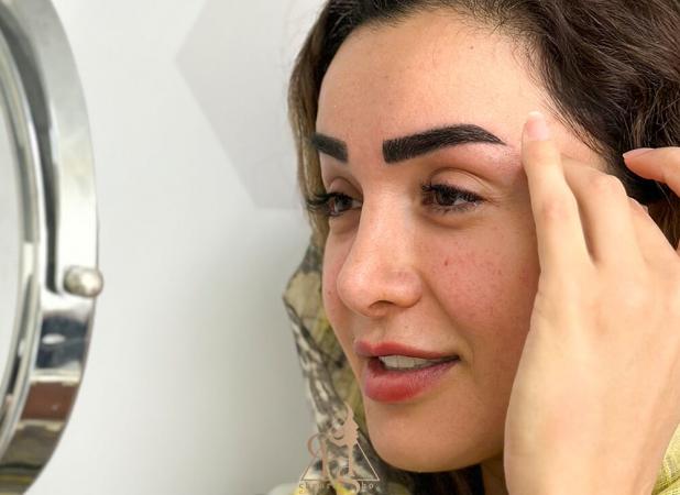 کاشت ابرو طبیعی؛ بازگرداندن زیبایی و اعتمادبه‌نفس با علم روز