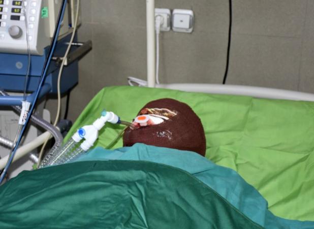 ماجرای اسیدپاشی هولناک روی پدر و دختر در تهران