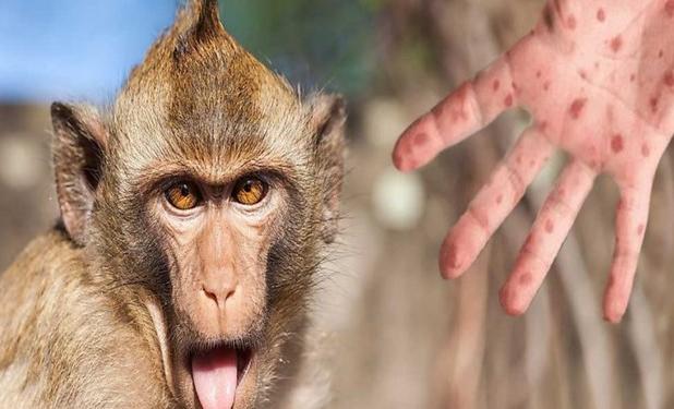 آخرین اطلاعات درباره «آبله میمون»/آیا باید از این ویروس بترسیم؟