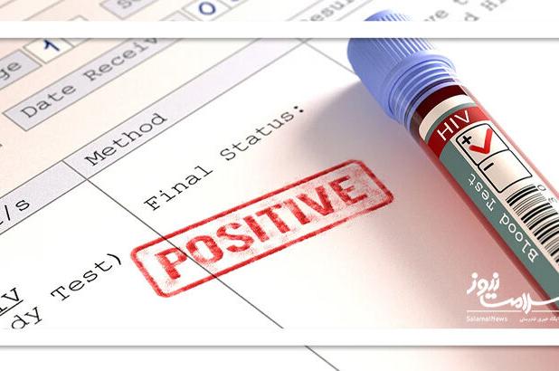 عکس/ 6 نشانه که ممکن است راش پوستی مرتبط با اچ آی وی داشته باشید