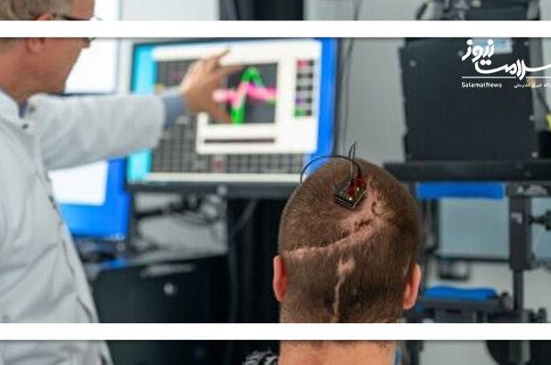 کاشت رابط مغز و رایانه در بیمار مبتلا به فلج کامل برای نخستین‌بار در اروپا