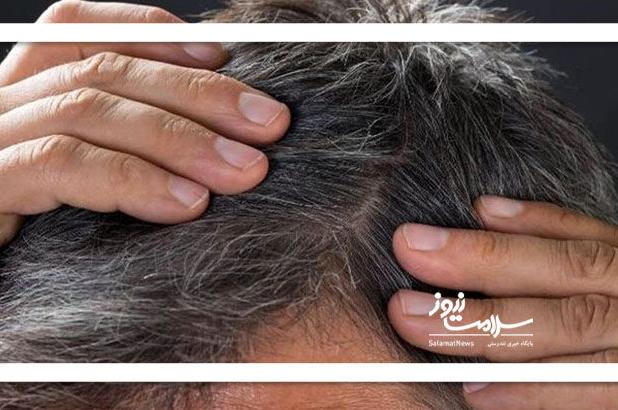 ارتباط میان سفیدی مو و سرطان ملانوما