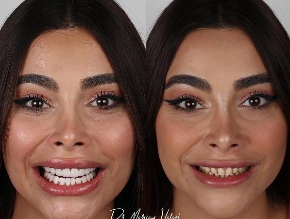 بهترین دندانپزشک زیبایی در تهران + لیست ۱۰ دندانپزشک برتر