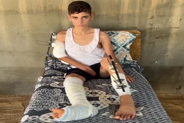 «احمد العبادله»؛ کودکی که جنگ و مورچه‌ها در چادر مرگ او را می‌بلعند