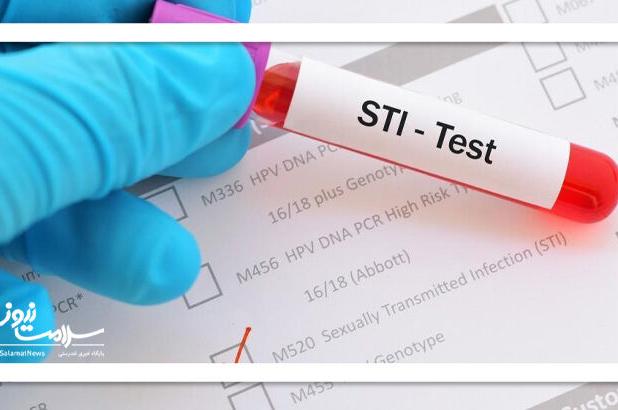 سوالات متداول در مورد بیماری های مقاربتی