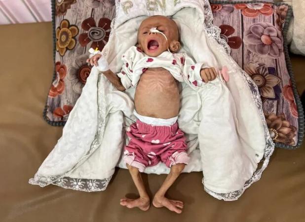 شهادت نوزاد ۶ ماهه فلسطینی بر اثر شدت گرسنگی