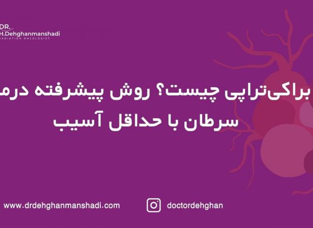 براکی‌تراپی چیست؟ روش پیشرفته در سرطان با حداقل آسیب