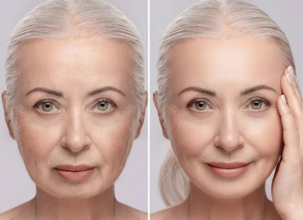 چه سرمی برای لیفت صورت خوبه؟