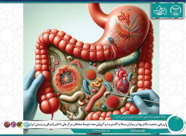 محققان ایرانی ترکیب میکروبی معده بیماران را بررسی کردند