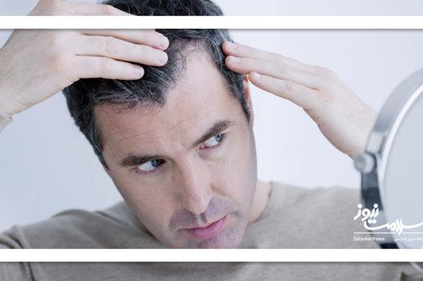راز موهای سالم با طب ایرانی؛ درمانی طبیعی، ارزان و مؤثر