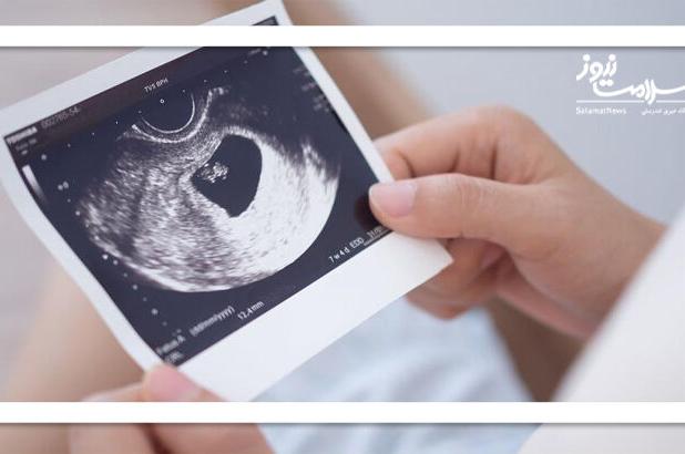 آیا سن محدودیتی برای بارداری زنان ایجاد می‌کند؟