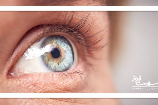 تهدیدات سلامت چشمی را بشناسید