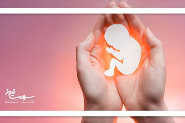 سقط جنین و سندرومی که می‌تواند زندگی مادر را تغییر دهد