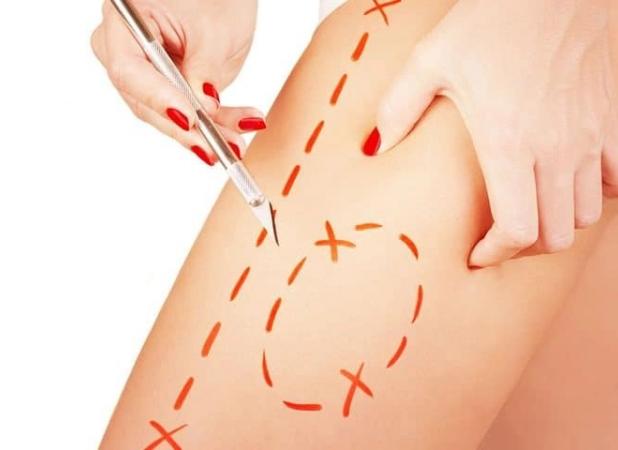 جراحی لیفت ران چیست و به چه روش هایی انجام می شود؟
