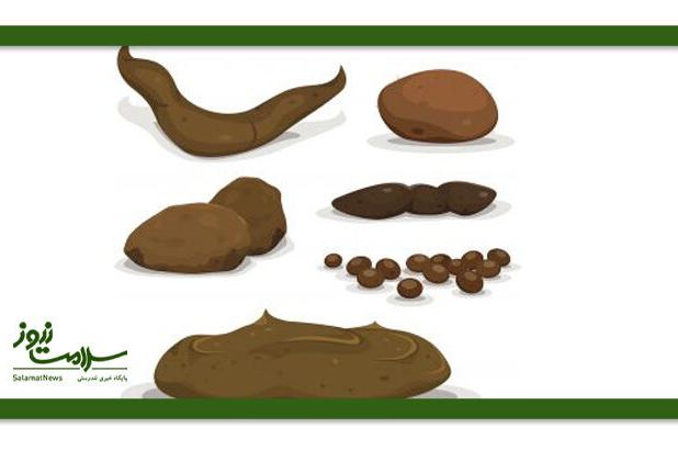 پیوند مدفوع؛ درمان جدید افسردگی؟