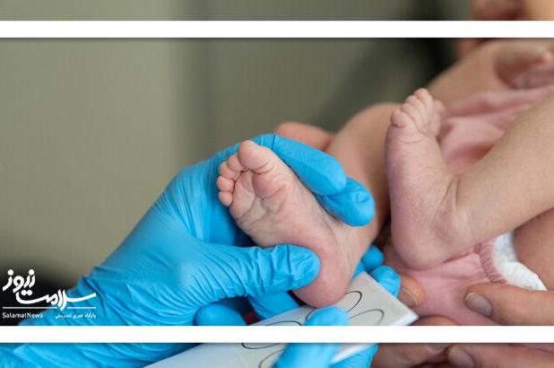 غربالگری نوزادان پیشگیری از عوارض مادام‌العمر کم‌کاری تیروئید