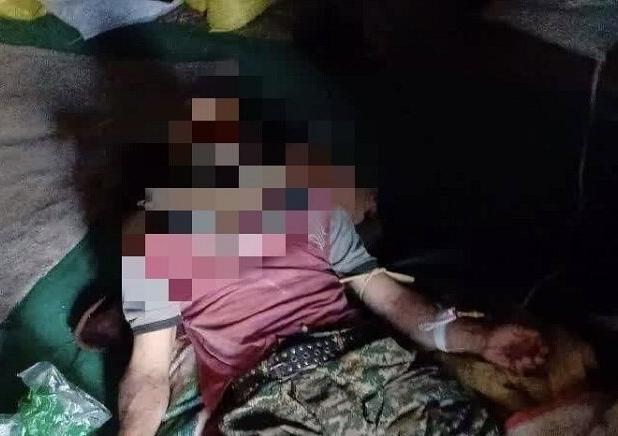 حمله خرس به یک کوهنورد در کوه‌های روستای بارز؛ نجات مصدوم با بالگرد