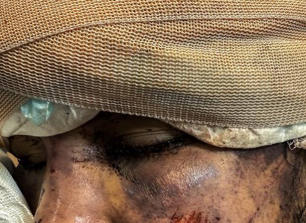 رد خون تروریسم روی «سلامت» ؛ هدف از حمله به آمبولانس‌ها چیست؟