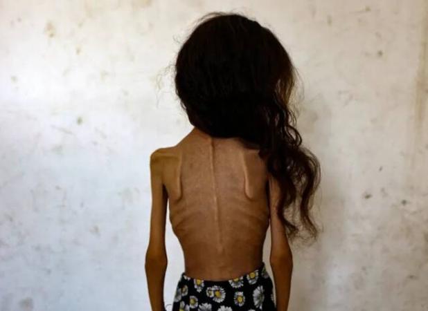 «بدون شرح»؛ کاریکاتور تلخ نشریه ایتالیایی در واکنش به گرسنگان غزه+ عکس