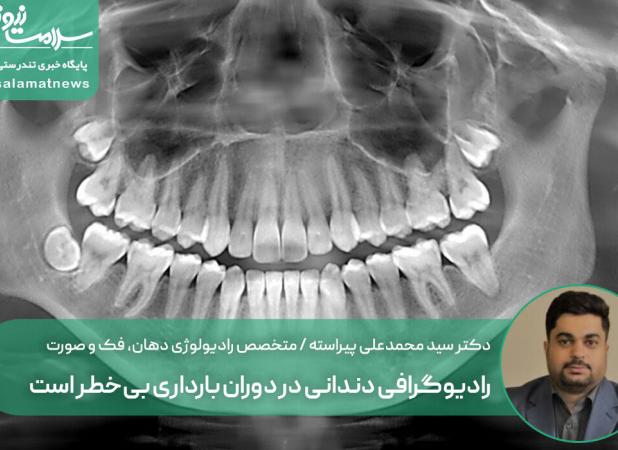 رادیوگرافی دندانی در دوران بارداری بی‌خطر است؛ رعایت اصول ایمنی ضروری است