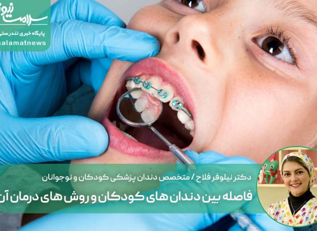 فاصله بین دندان های کودکان و روش های درمان آن