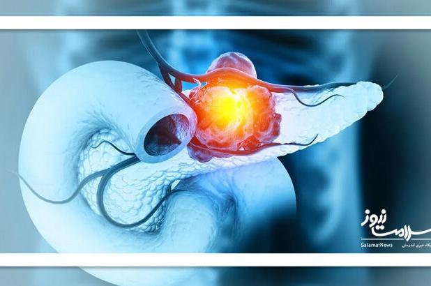 گامی بزرگ در درمان یکی از مرگبارترین سرطان‌ها