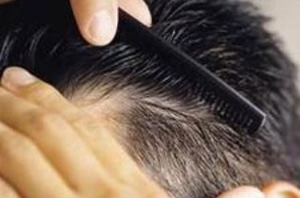 راهکارهای طب ایرانی برای تقویت مو؛ تجربه‌ای طبیعی و کم‌هزینه