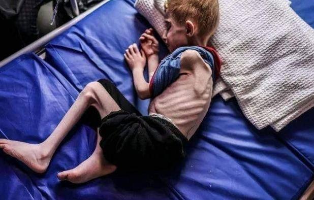 ۲۹۰ هزار کودک در نوار غزه در آستانه مرگ