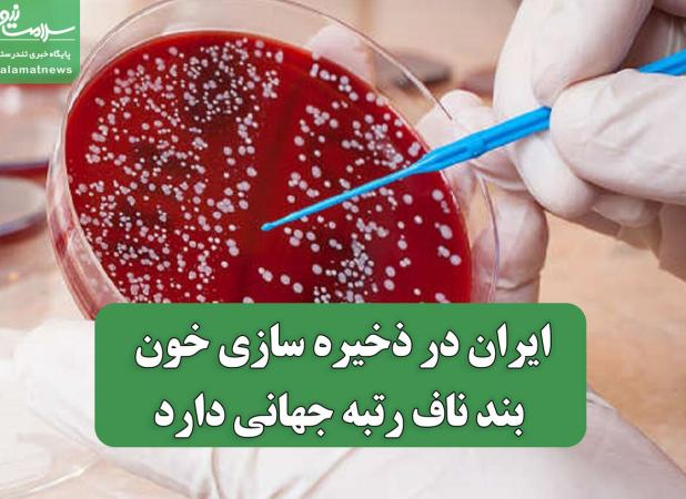 ایران در ذخیره سازی خون بند ناف رتبه جهانی دارد