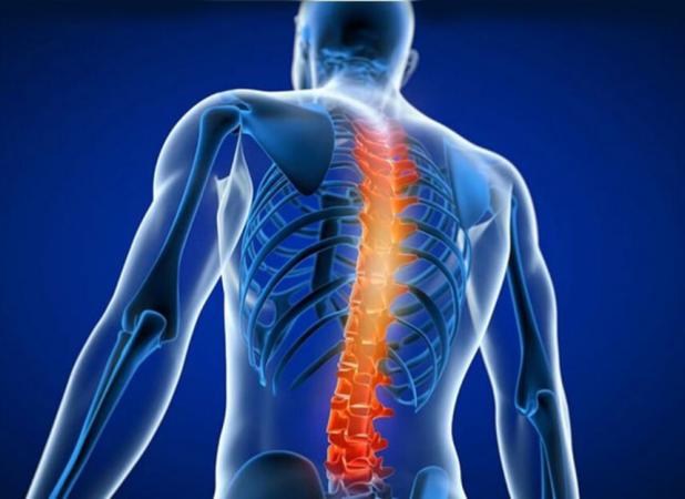 بلوک‌ های عصبی در درمان التهاب مفاصل کمر