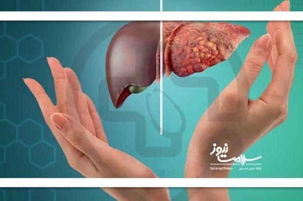 کبد چرب؛ بیماری خاموش قرن کم‌تحرکی