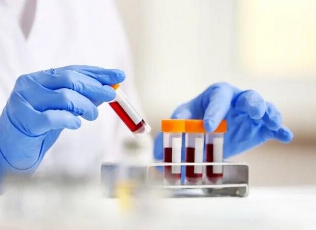 غربالگری کلسترول کودکان ضروری است؟